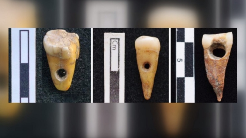 Çatalhöyük'te kasıtlı olarak değiştirilmiş insan dişlerinin ilk örnekleri bulundu